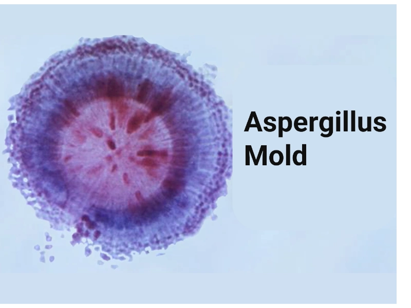 Aspergillus mold Gainesville home