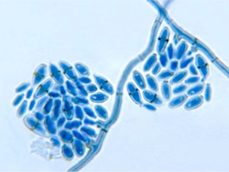 Cladosporium mold Gainesville home