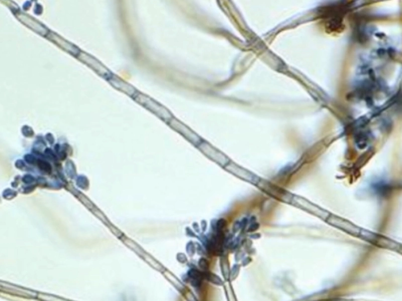 Cladosporium mold spots Gainesville